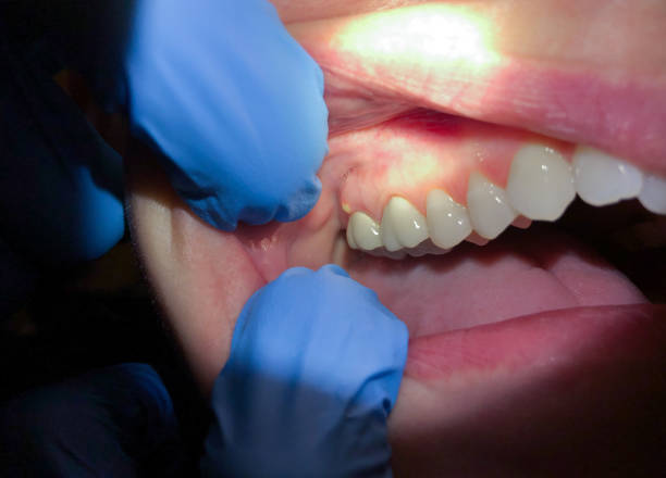 Best Emergency Dental Care for Broken or Chipped Teeth in Hope, AR